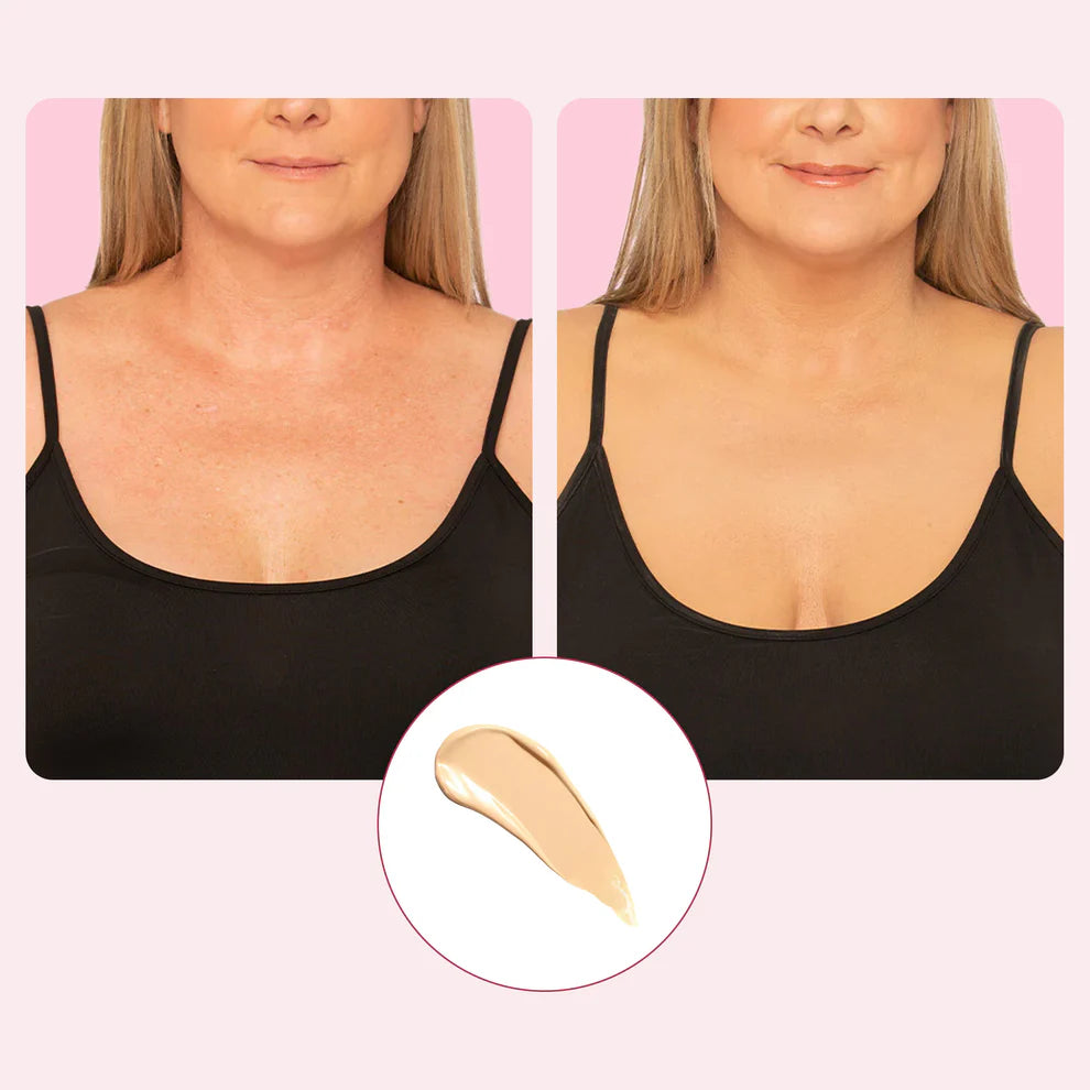 Velisse™ Body Coverage Protector