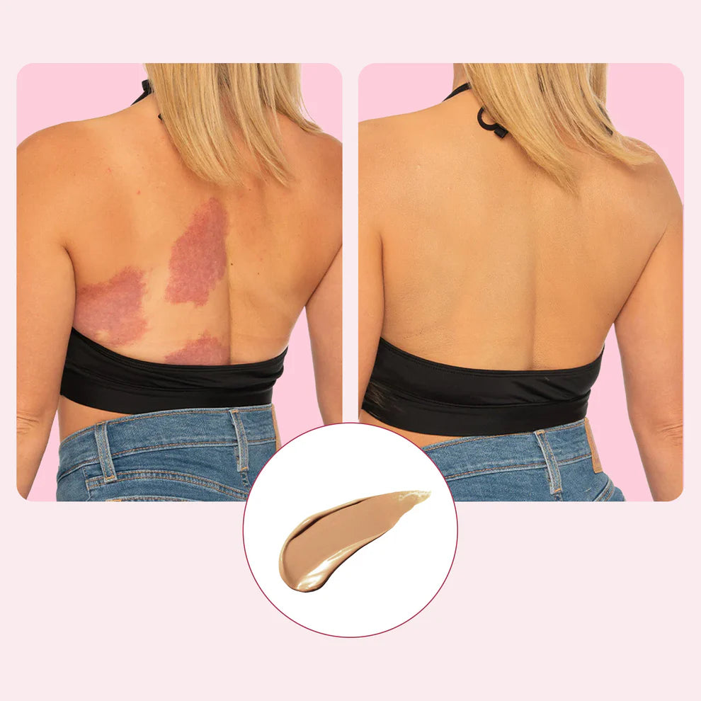 Velisse™ Body Coverage  Protector