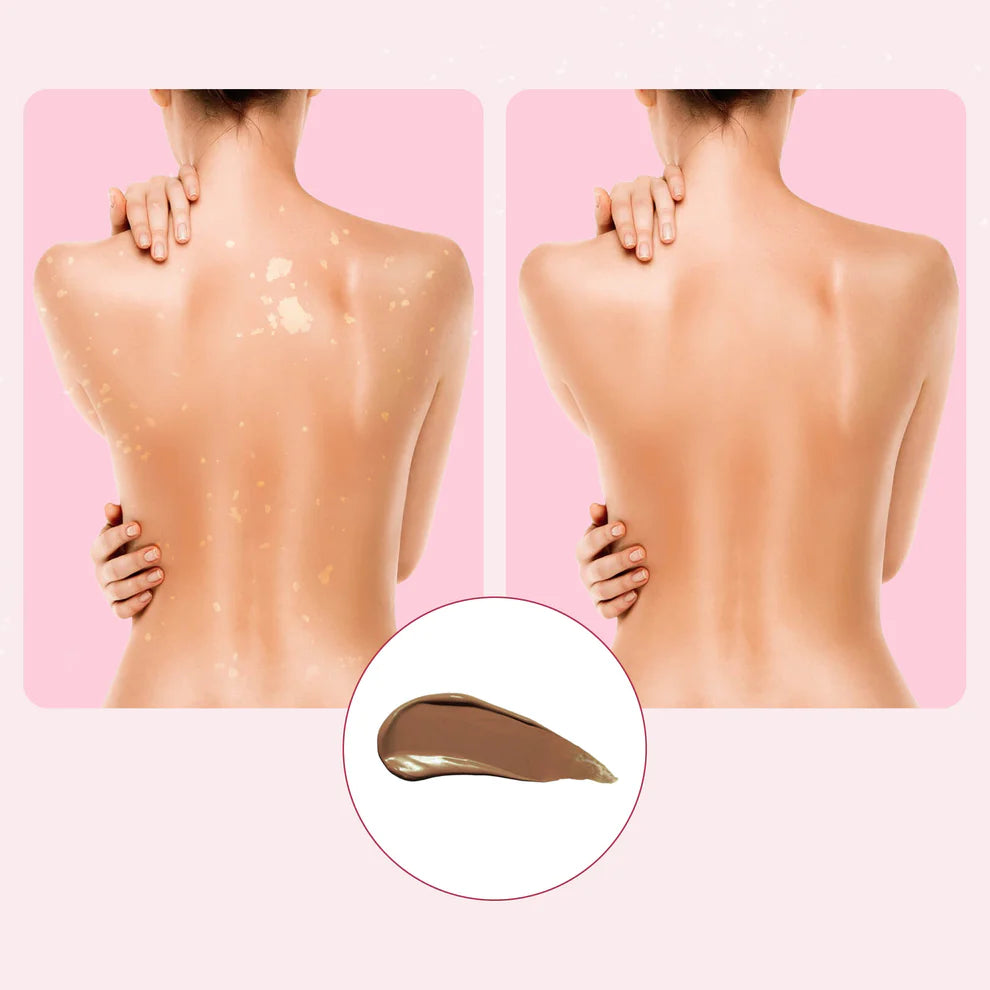 Velisse™ Body Coverage  Protector