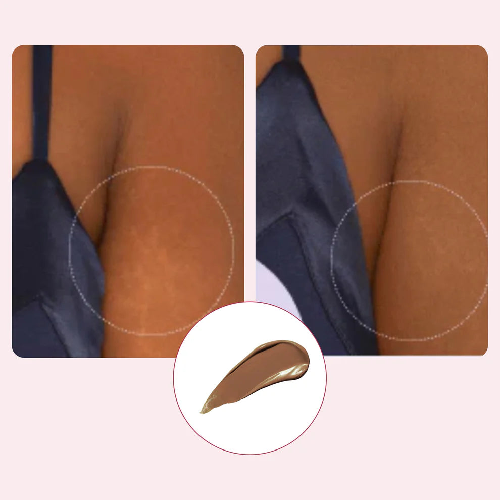 Velisse™ Body Coverage  Protector