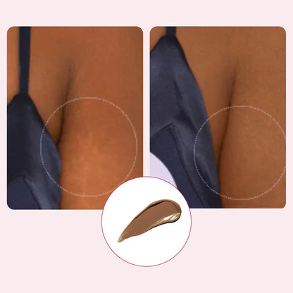Velisse™ Body Coverage  Protector