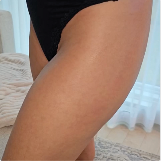 Velisse™ Anti-Cellulite Massager